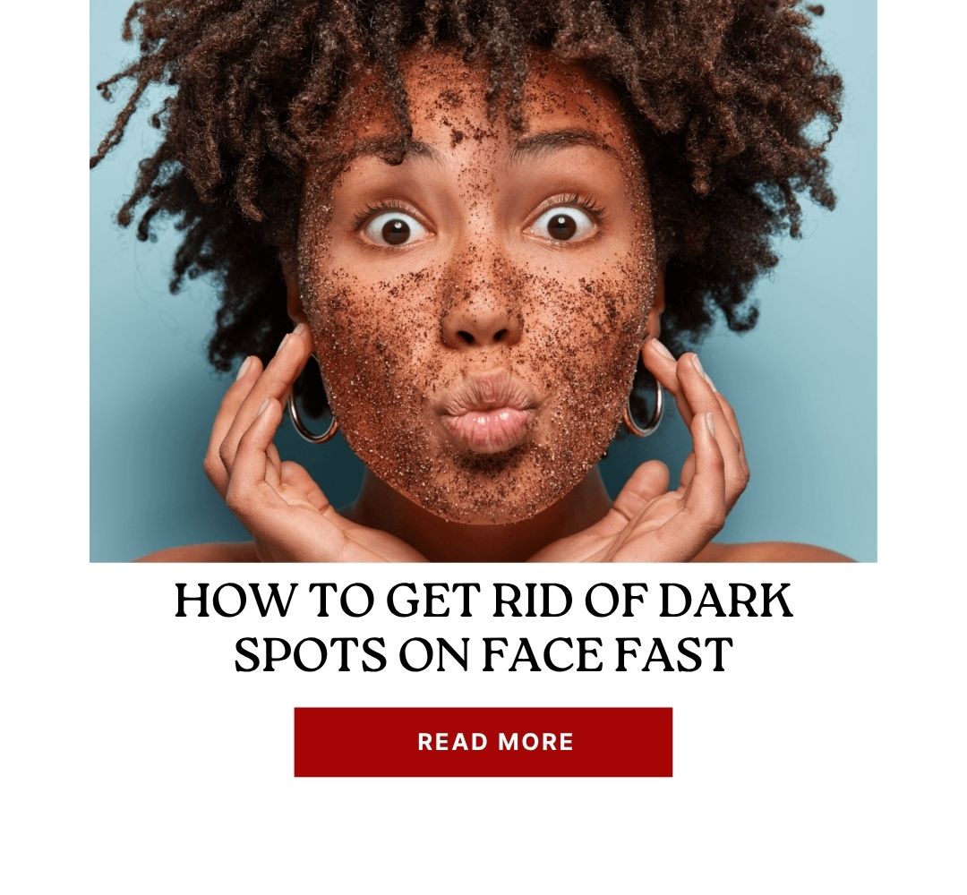 How to Get Rid of Dark Spots on Face Fast